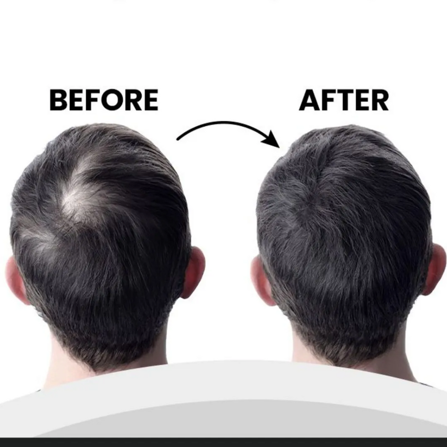 لويس بيان بودرة ألياف الشعر لتغطية فورية وفراغات أقل | لون بني 20 غرام