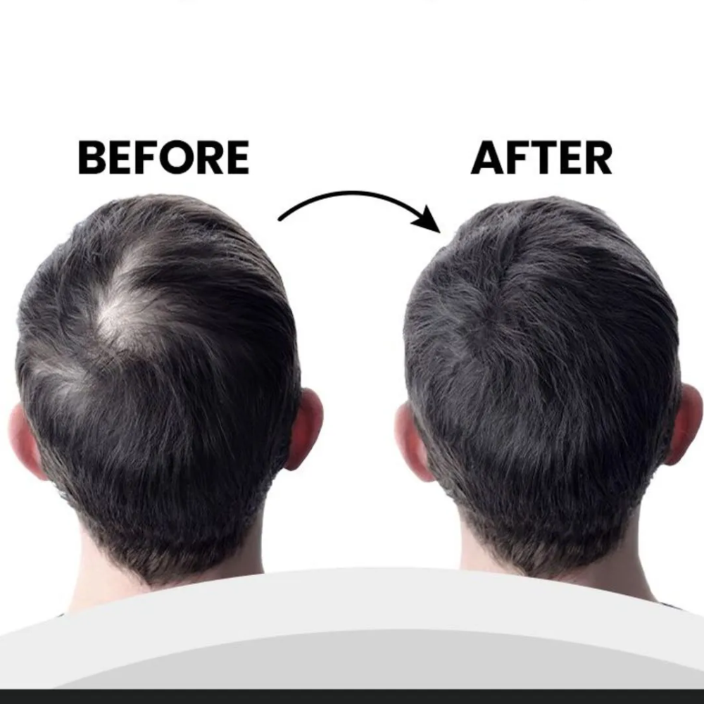 لويس بيان بودرة ألياف الشعر لتغطية فورية وفراغات أقل | لون بني 20 غرام