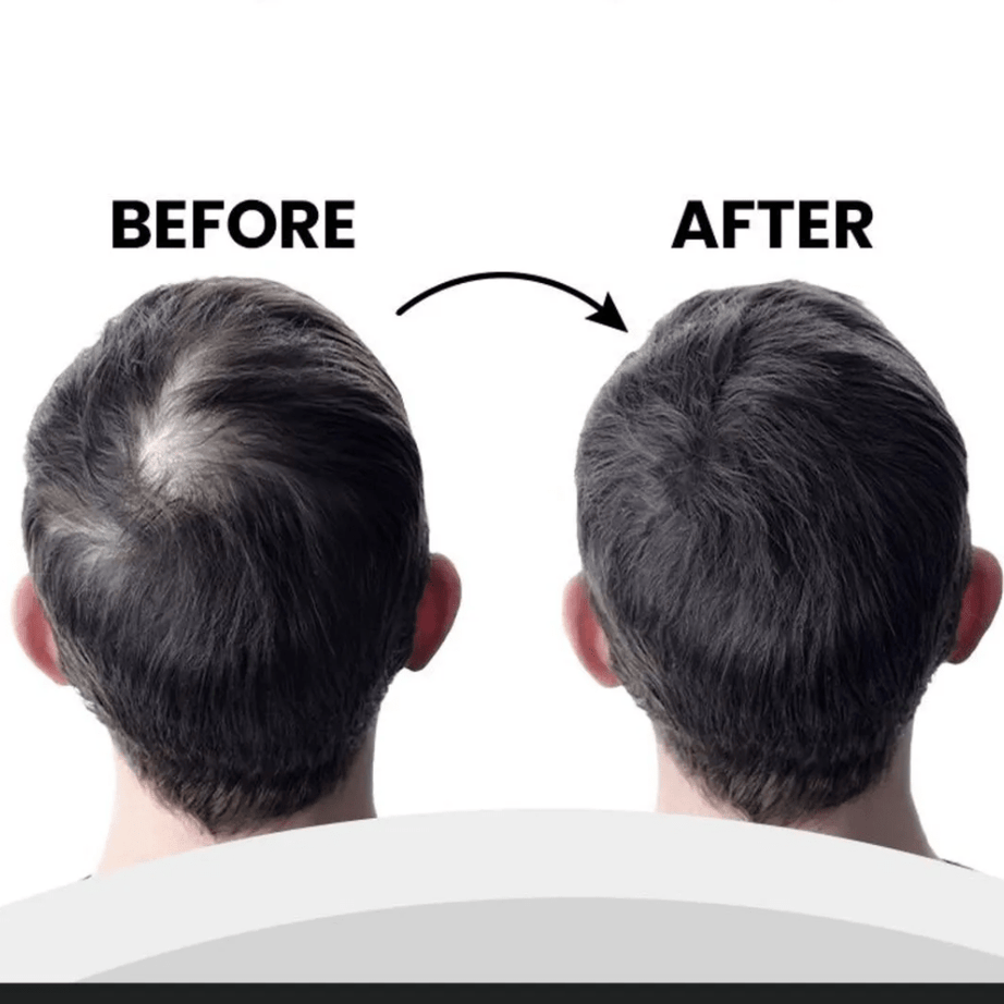 لويس بيان بودرة ألياف الشعر لتغطية فورية وفراغات أقل | لون أسود 20 غرام