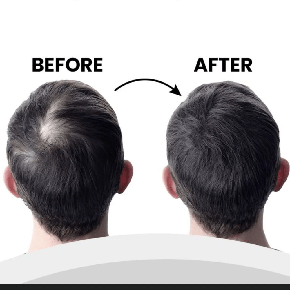 لويس بيان بودرة ألياف الشعر لتغطية فورية وفراغات أقل | لون أسود 20 غرام